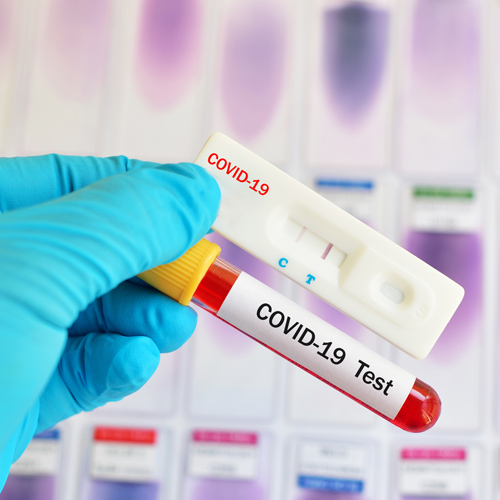 Scientist reviewing COVID test samples Scientist reviewing COVID test samples