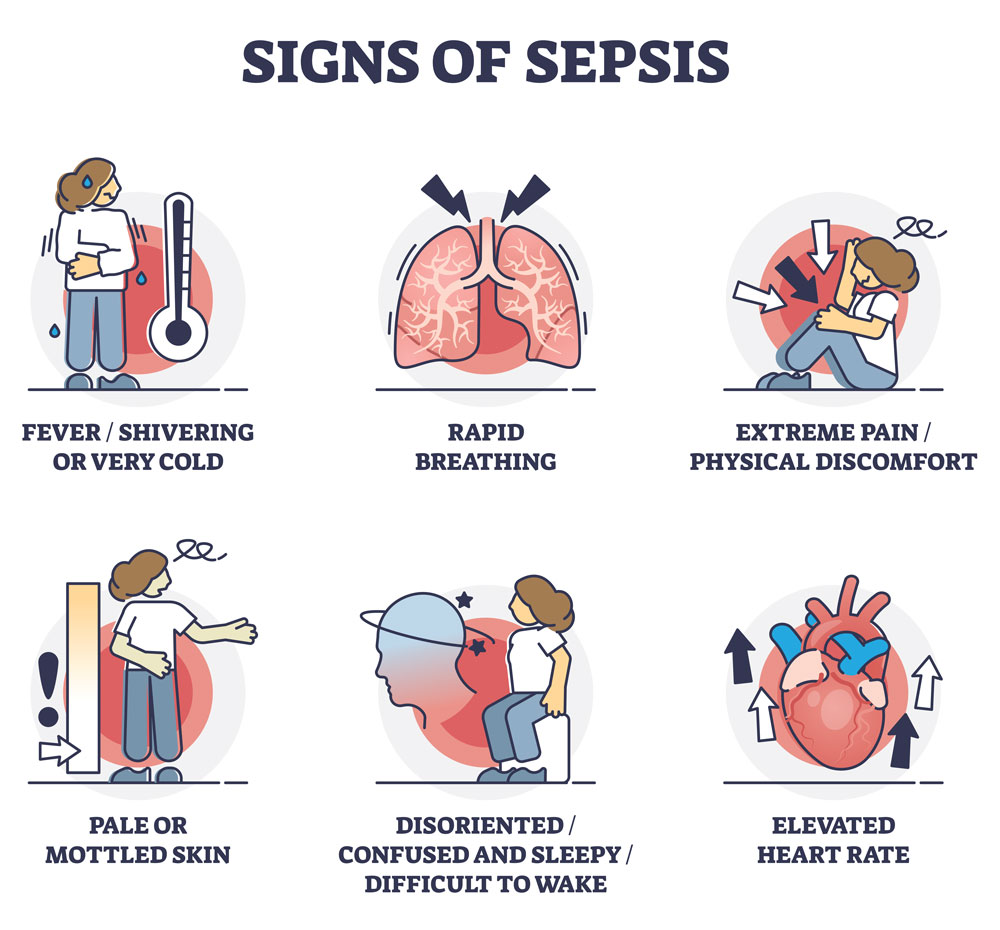 Signs-of-Sepsis